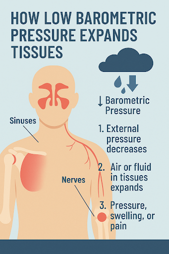 Barometric Pressure And Joint Pain