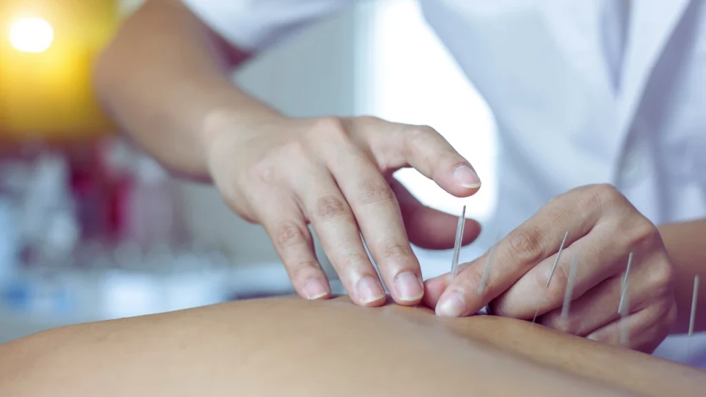 Hip Acupuncture Burnaby Physiotherapy