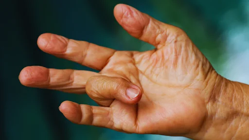 What Is Trigger Finger