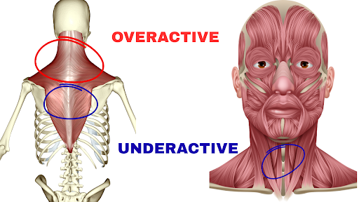 Persistent Shoulder Pain